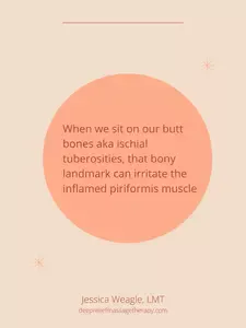 piriformis syndrome treatment