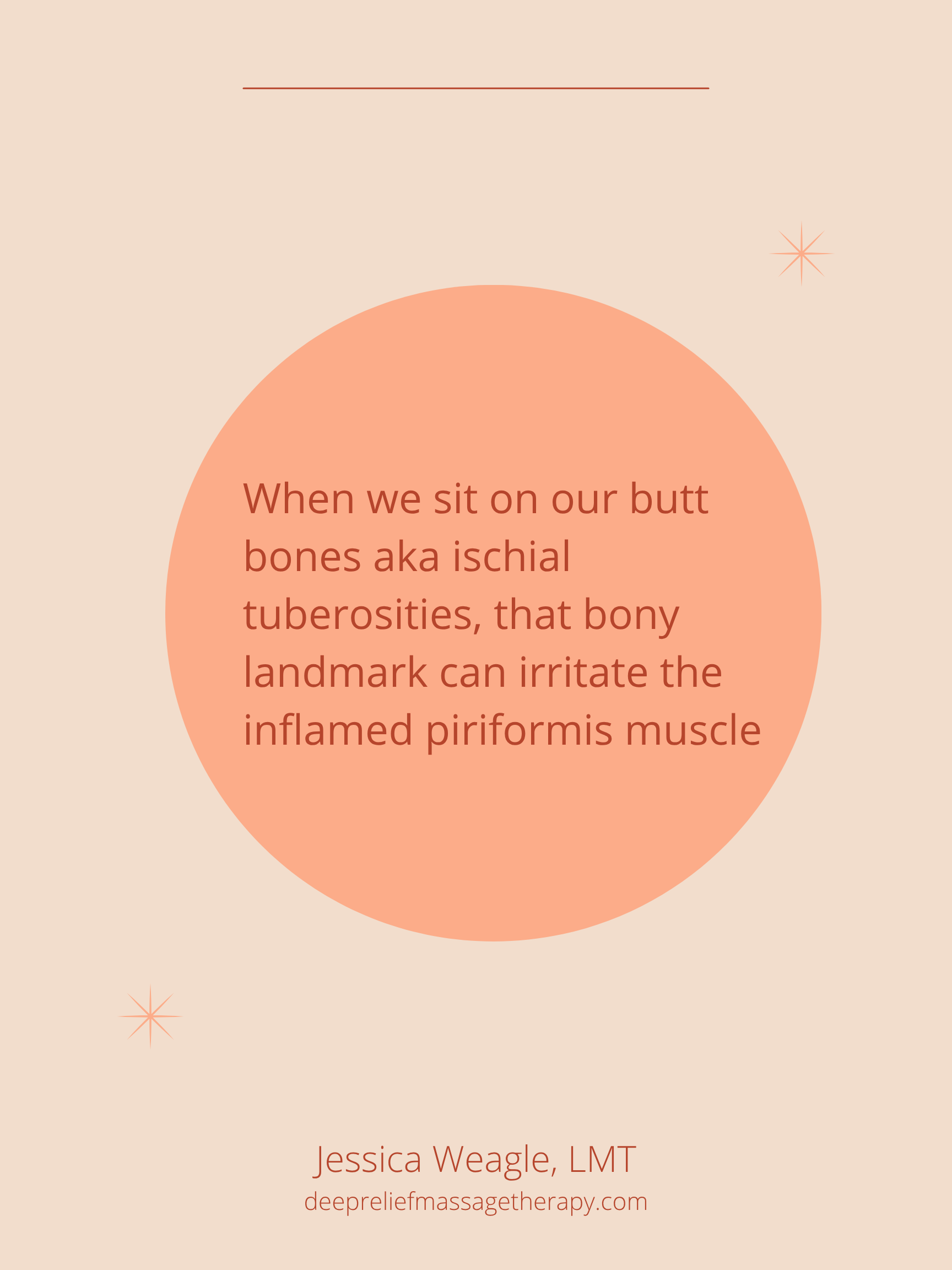 piriformis syndrome treatment